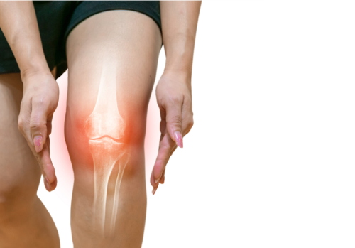 Jak může pomoci fyzioterapie při OSTEOARTÓZE?
