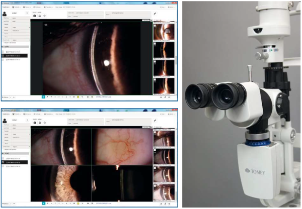 Foto štěrbinová lampa TOMEY TSL-800